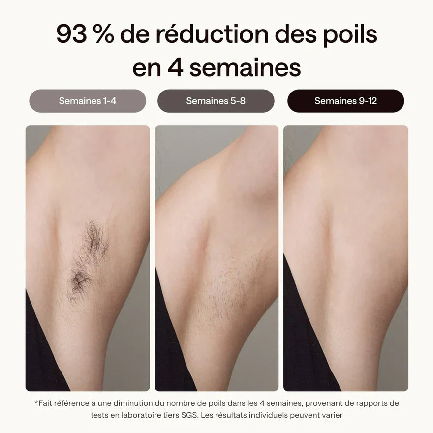 Épilateur Max 2 – Épilation Permanente à Domicile