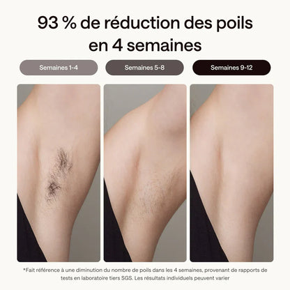 Épilateur Max 2 – Épilation Permanente à Domicile